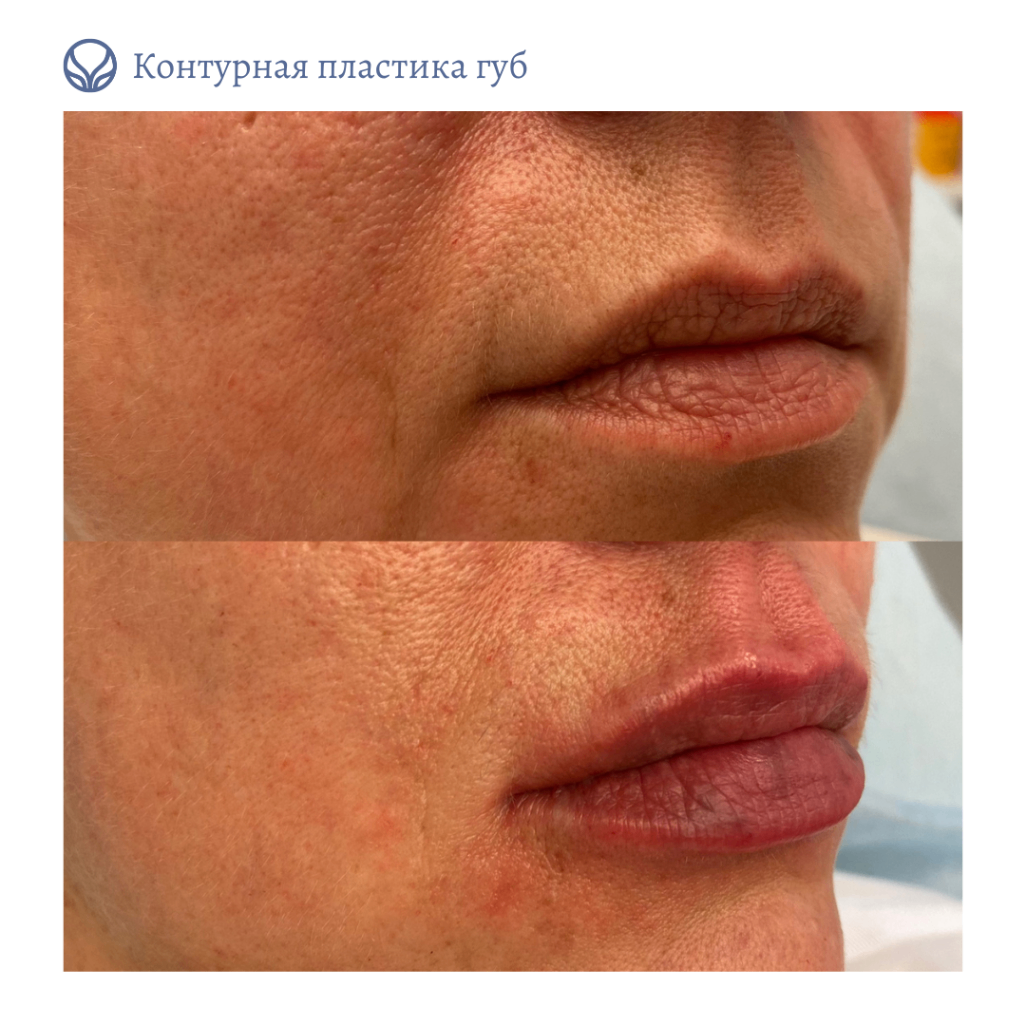 63550010__https://filllin.ru/api/media/doctor/48d7ac00-fba3-4773-8756-9795f28f3b0c-6641d6971b708b73903b2c1d.png