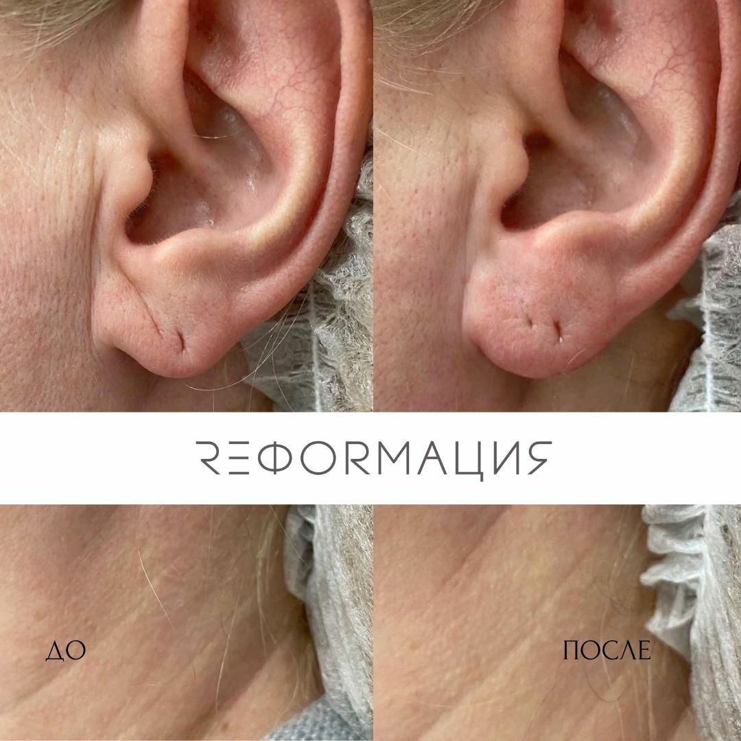 450948522__https://filllin.ru/api/media/doctor/48deb5e9-82b4-4c01-9da5-4fbd1ccdfe1c-6641d6971b708b73903b2c1d.jpg