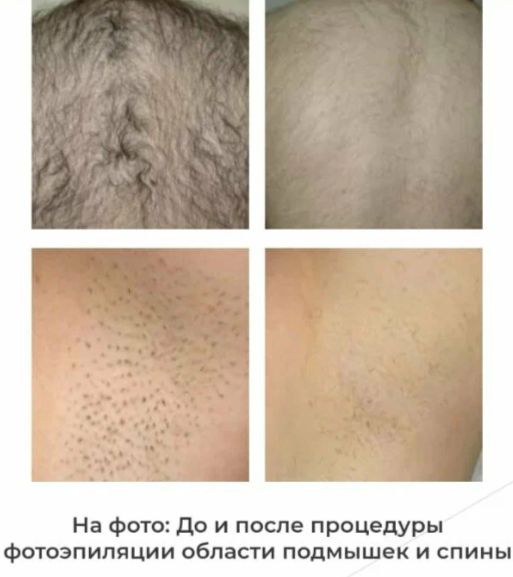 209665964__https://filllin.ru/api/media/doctor/4953f396-efdf-44fa-bdf0-3b04c3025a8d-6641d6971b708b73903b2c1d.png
