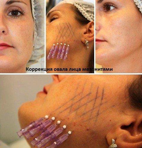 131507191__https://filllin.ru/api/media/doctor/4d471712-62a7-4726-b36a-472407cbfb78-6641d6971b708b73903b2c1d.jpg