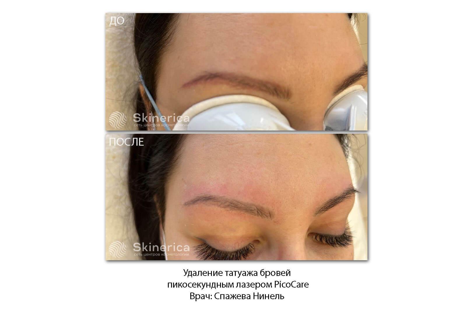 211570337__https://filllin.ru/api/media/doctor/4ec56c56-f0b9-4d54-bf58-07ba4e5162a8-6641d6971b708b73903b2c1d.jpg