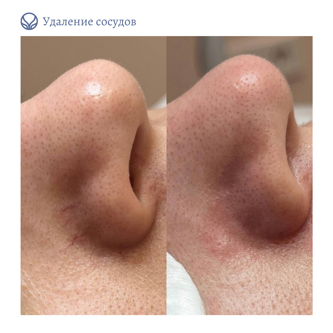 67246707__https://filllin.ru/api/media/doctor/50d8fa07-39ee-4b34-b155-876296249cb9-6641d6971b708b73903b2c1d.png