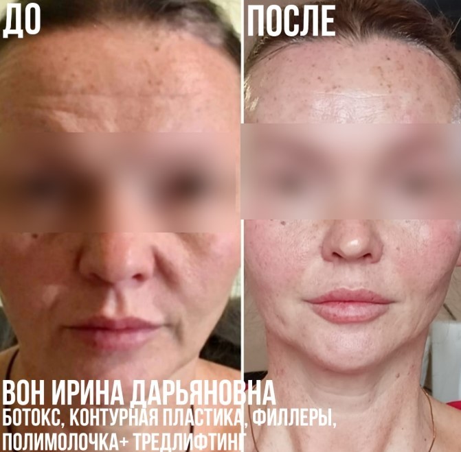 459598206__https://filllin.ru/api/media/doctor/5371b976-6f3e-4538-baa4-ab597e708d41-6641d6971b708b73903b2c1d.jpg