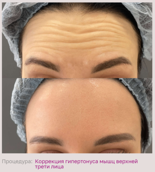 602492197__https://filllin.ru/api/media/doctor/539be413-6a1c-437a-b37f-2135eab9f5c2-68d2b334d611ae3c0dcef079.png