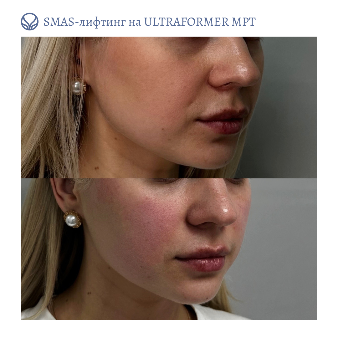 64844681__https://filllin.ru/api/media/doctor/572456ff-0c8e-48b7-bfd5-0a4c78344eba-6641d6971b708b73903b2c1d.png