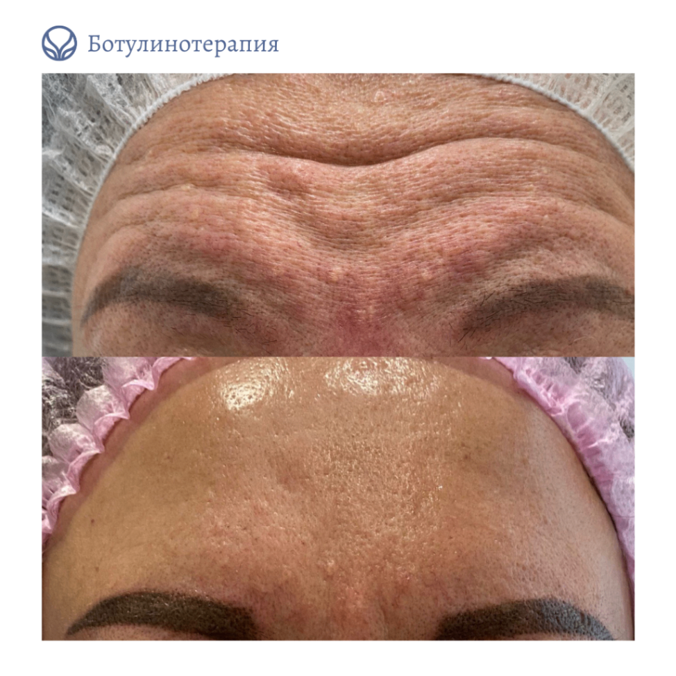 68347819__https://filllin.ru/api/media/doctor/58236e75-5a43-46a2-beb6-ab83d7564cb7-6641d6971b708b73903b2c1d.png