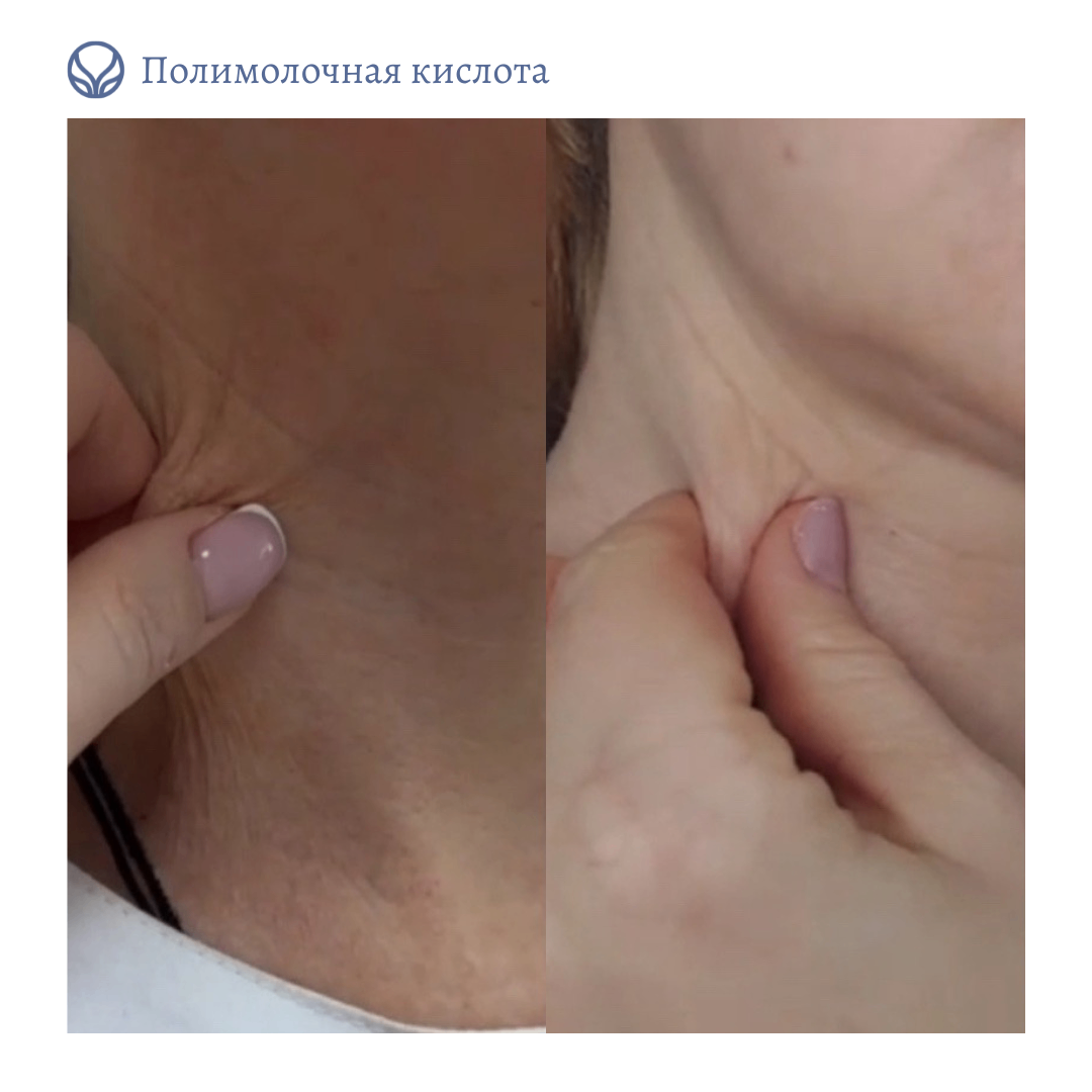 63423279__https://filllin.ru/api/media/doctor/5950270a-cb4b-4490-a2f2-d2befe3ea486-6641d6971b708b73903b2c1d.png