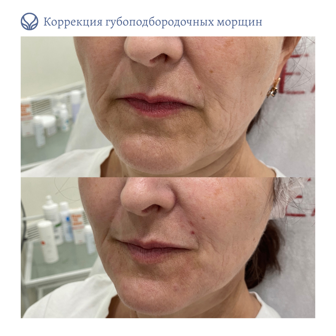 68347819__https://filllin.ru/api/media/doctor/5a37eaa0-aeb6-4809-818e-0286a1ba7c98-6641d6971b708b73903b2c1d.png