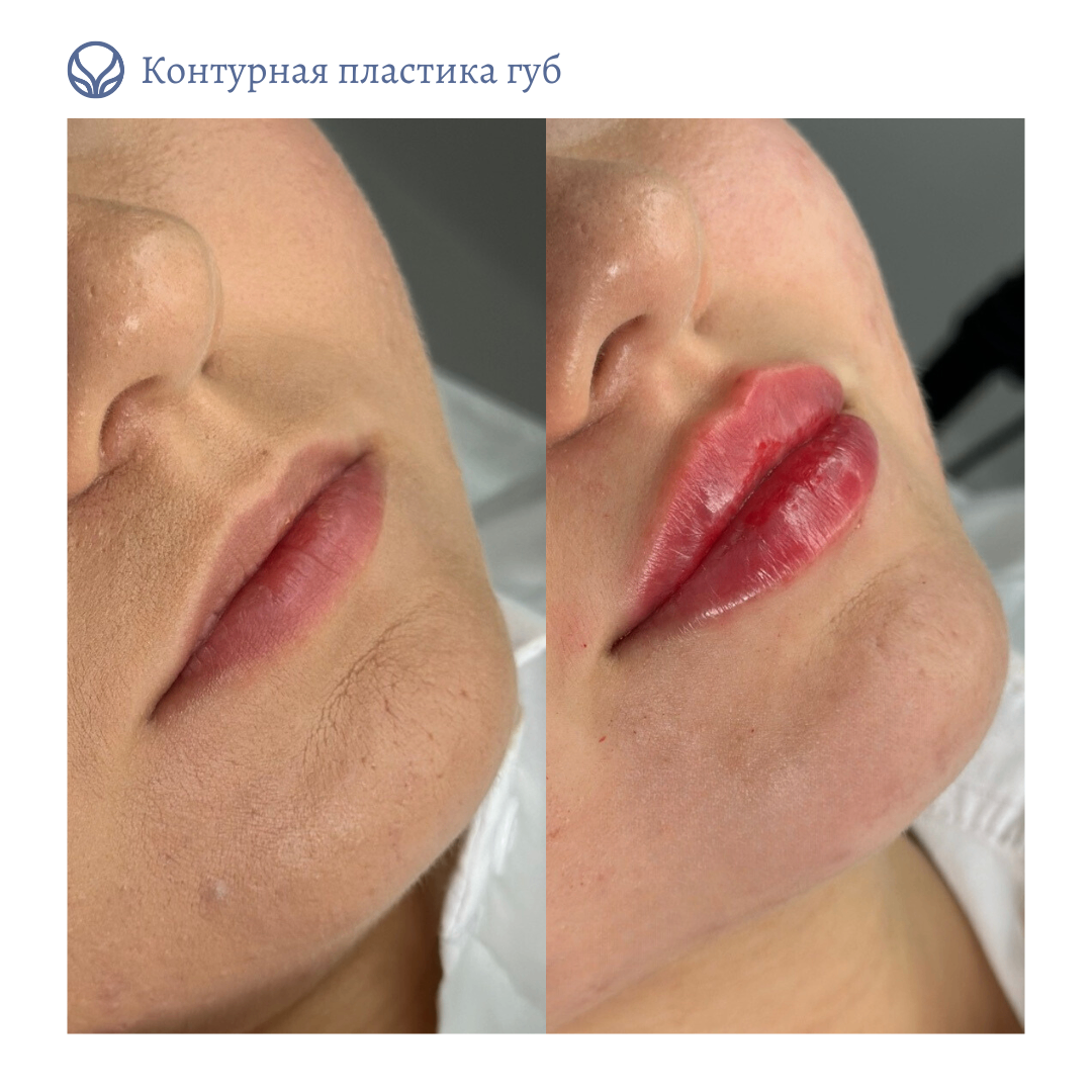 63423279__https://filllin.ru/api/media/doctor/5a4cc5c9-e7e8-45ea-94fb-31804d682bfe-6641d6971b708b73903b2c1d.png