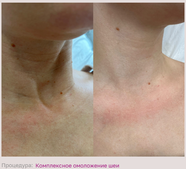 584315182__https://filllin.ru/api/media/doctor/5a9b8c16-ff16-4e21-8893-3c079c1722d0-68d2b334d611ae3c0dcef079.png