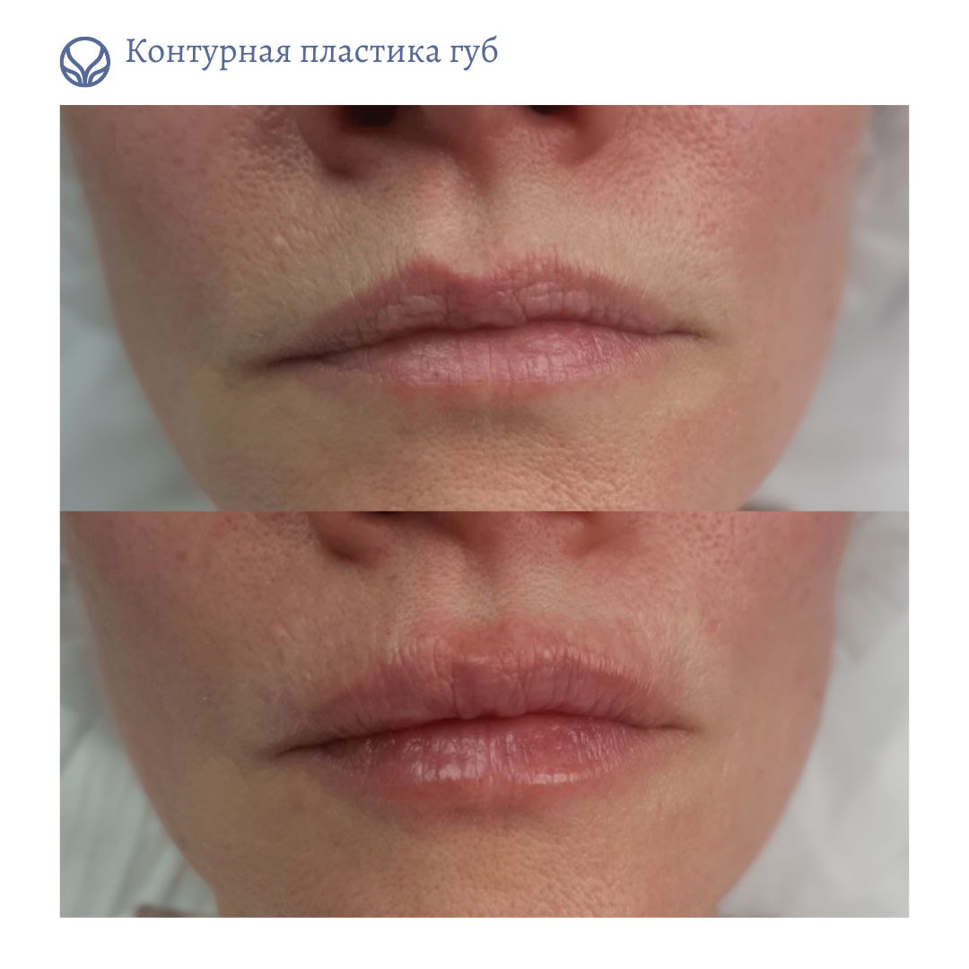67216317__https://filllin.ru/api/media/doctor/5b04844d-f866-4341-92c1-7a3869911912-6641d6971b708b73903b2c1d.png