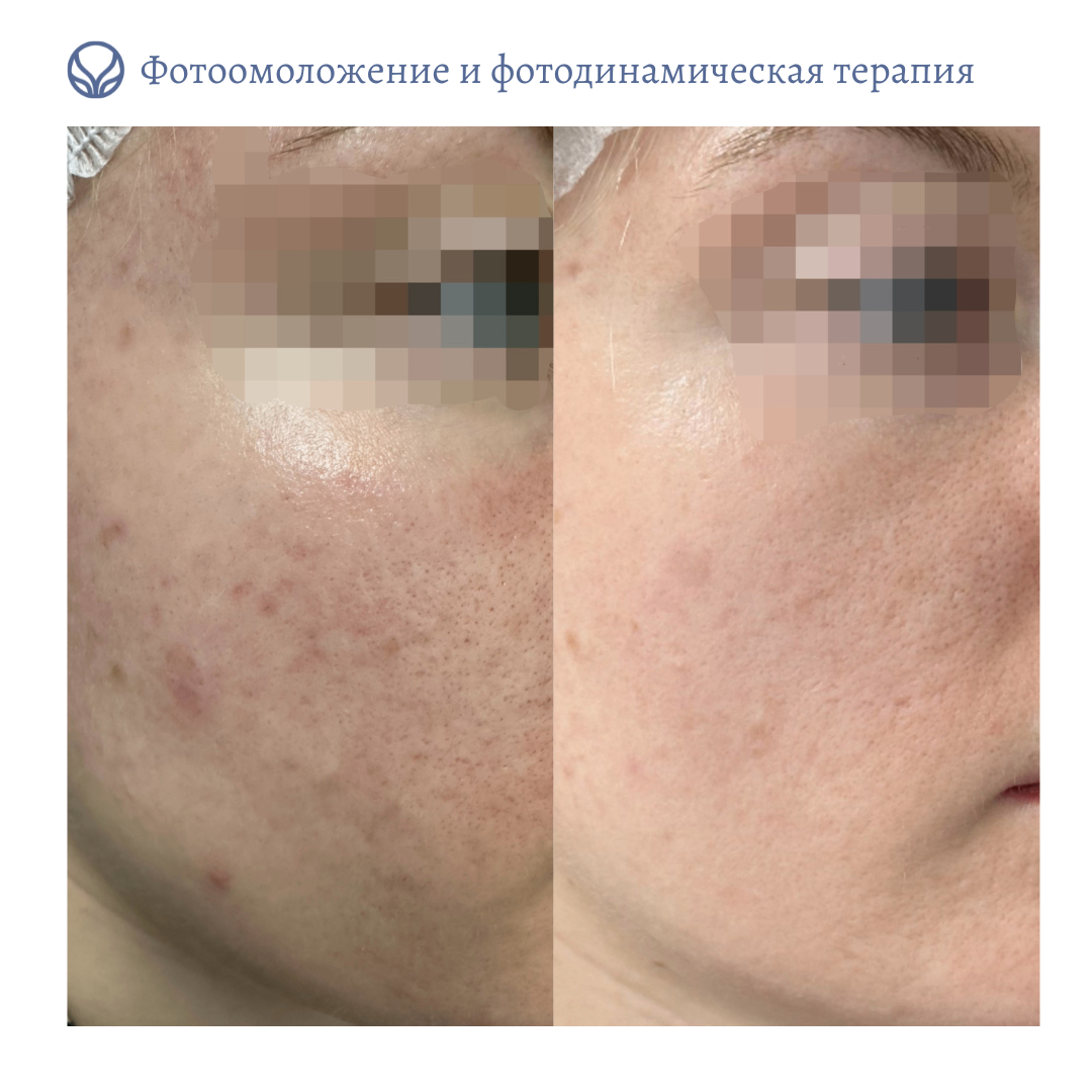 74143140__https://filllin.ru/api/media/doctor/5b204277-d37f-4b6b-93ca-2a15fbb1a419-6641d6971b708b73903b2c1d.png