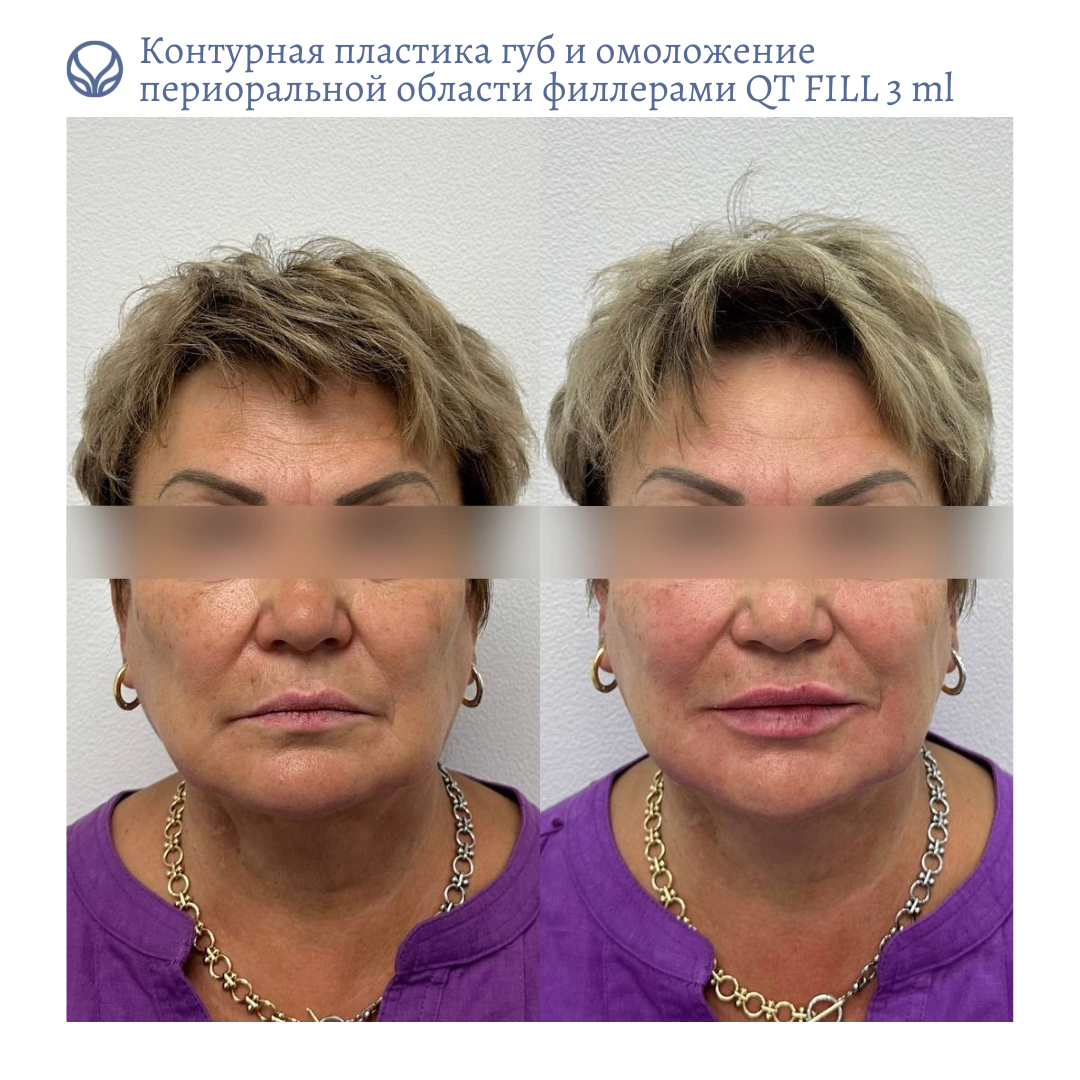 63423279__https://filllin.ru/api/media/doctor/5d28bdfc-334e-48f3-823f-63b1ae0a8f94-6641d6971b708b73903b2c1d.png