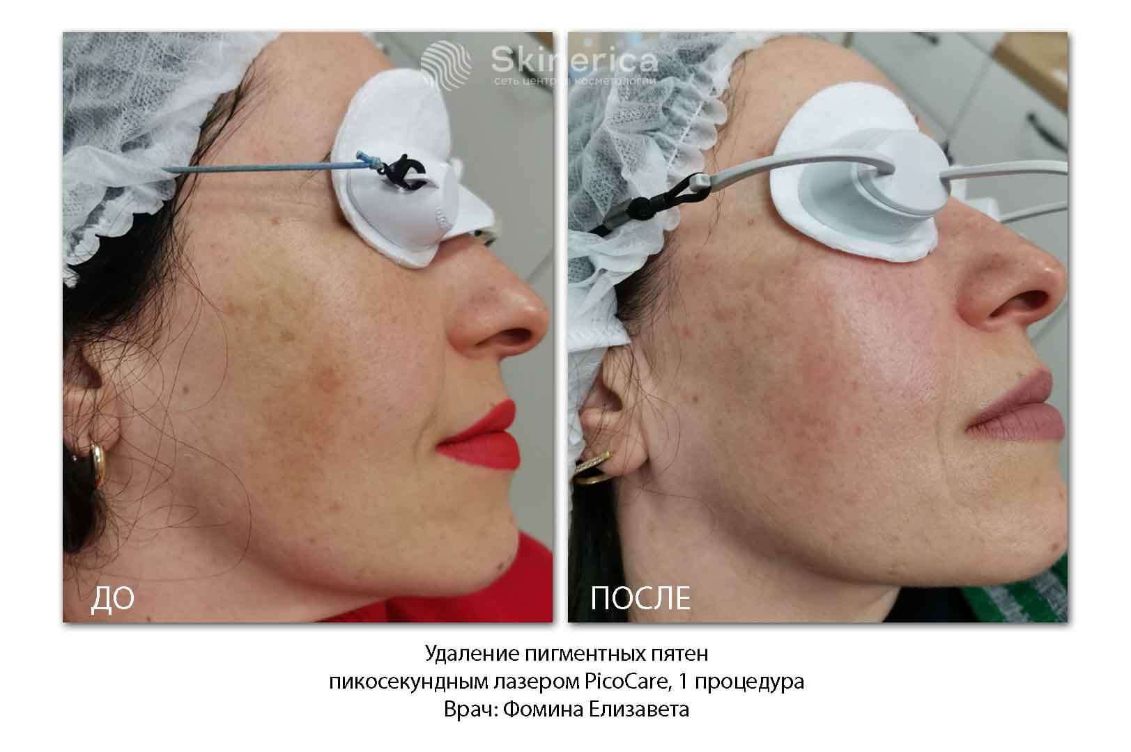 210725569__https://filllin.ru/api/media/doctor/62e57df7-37d5-47f7-8e44-e8350f32a266-6641d6971b708b73903b2c1d.jpg