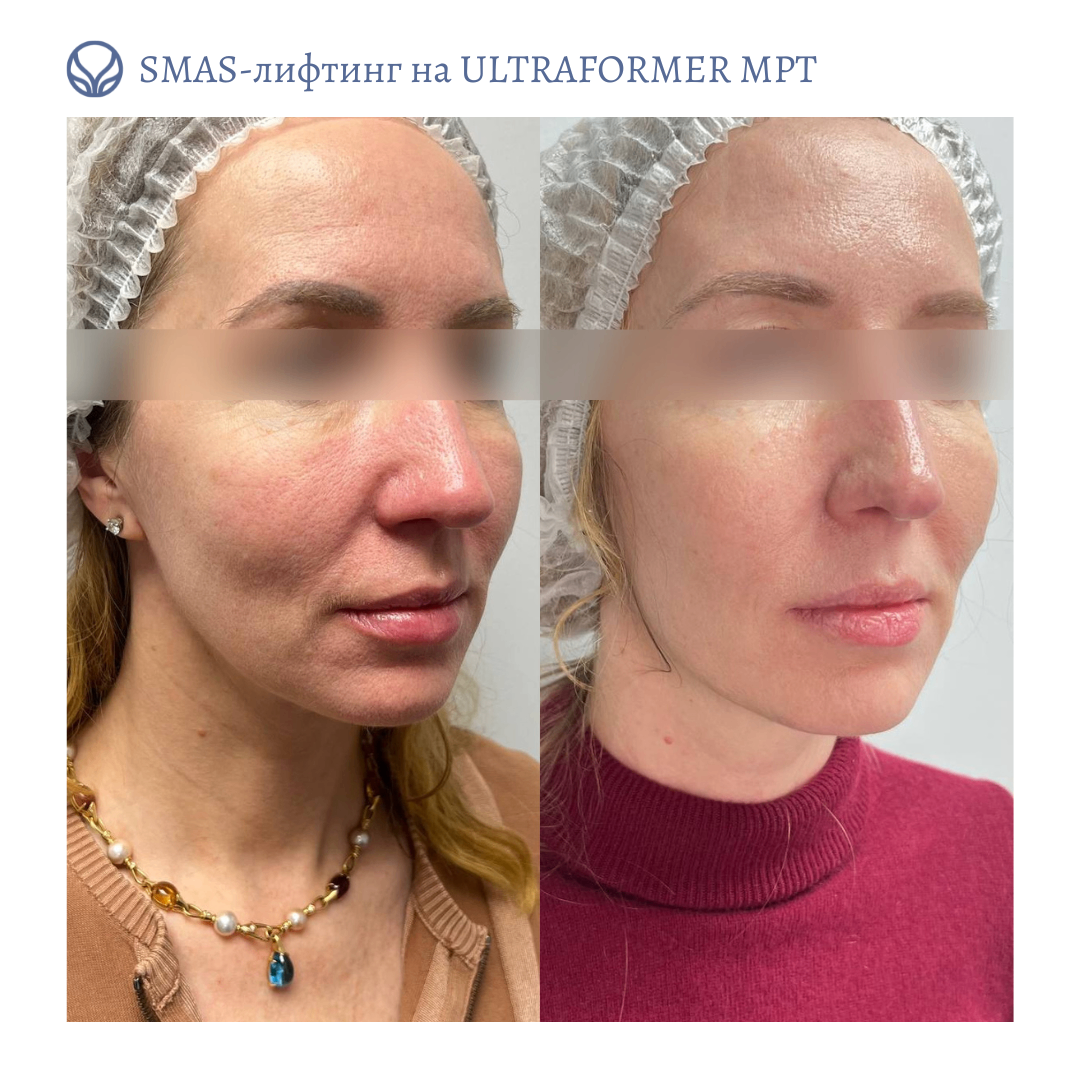64586679__https://filllin.ru/api/media/doctor/633eeedf-ddf9-4847-b0d4-1b7ff9252481-6641d6971b708b73903b2c1d.png