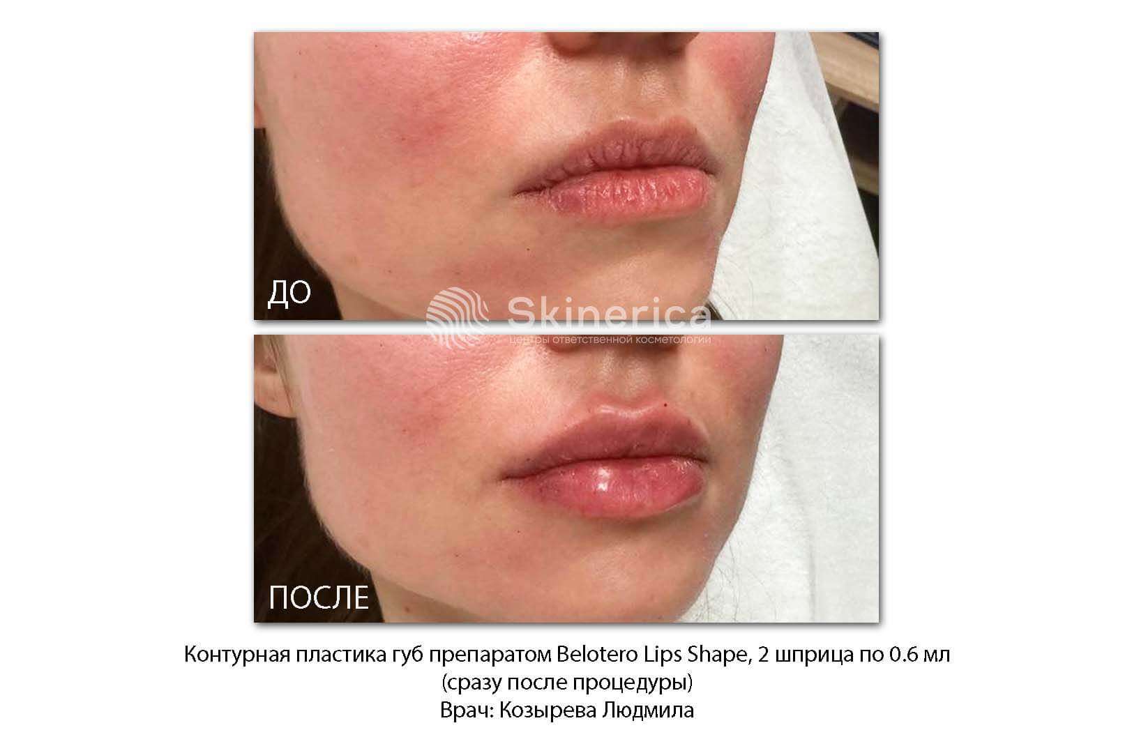 215338881__https://filllin.ru/api/media/doctor/634b00fd-6e18-4dfb-88e3-c058daf04257-6641d6971b708b73903b2c1d.jpg