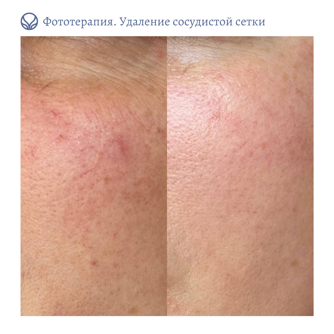 69138892__https://filllin.ru/api/media/doctor/63ba66c6-cc65-4eef-a4ca-bd58e58e2454-6641d6971b708b73903b2c1d.png