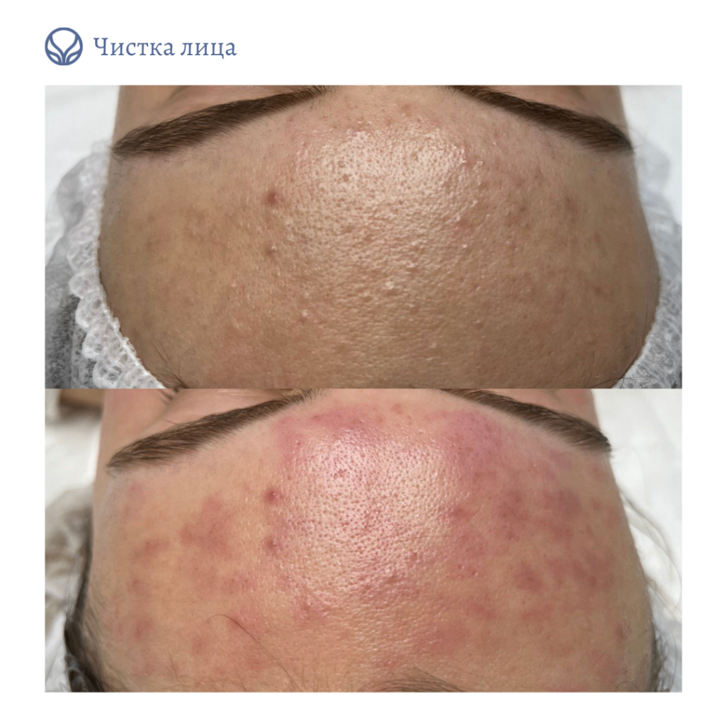 63568099__https://filllin.ru/api/media/doctor/64fe5e3e-bc60-429a-9d1e-33af35201bee-6641d6971b708b73903b2c1d.png