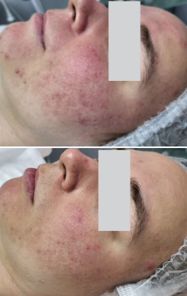 2809504__https://filllin.ru/api/media/doctor/664a7319-c1c2-41c5-9cea-d65b917af5e2-6641d6971b708b73903b2c1d.png
