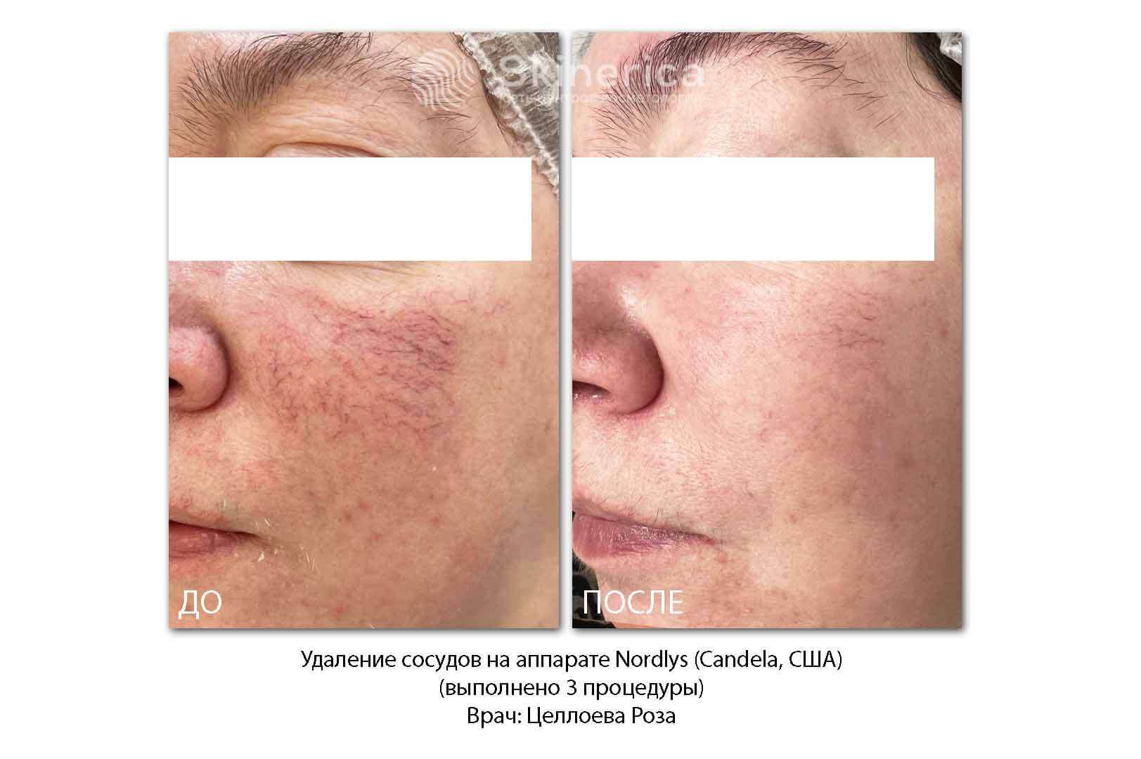 210725569__https://filllin.ru/api/media/doctor/6839ac31-520b-4184-8be6-782a6ed35ae3-6641d6971b708b73903b2c1d.jpg