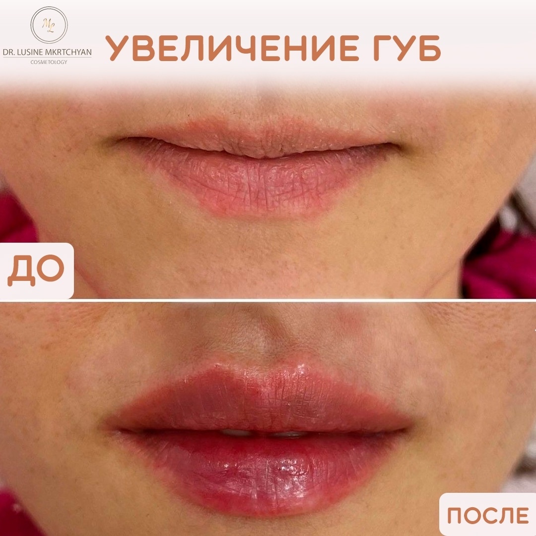 529741701__https://filllin.ru/api/media/doctor/6987aef4-dce5-4057-a1ce-7789ba095529-68d2b334d611ae3c0dcef079.jpg