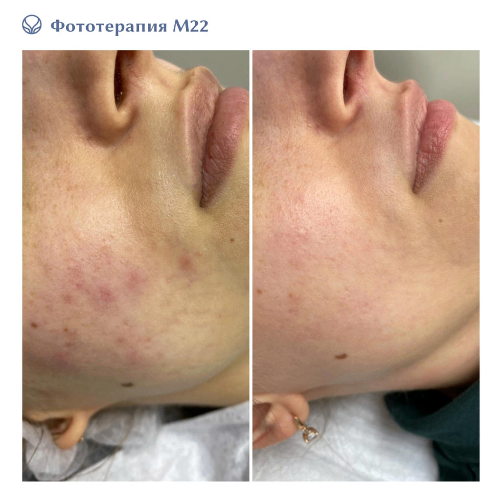 74143140__https://filllin.ru/api/media/doctor/6aa049a1-15b6-41a1-b2fc-bb08f21947d1-6641d6971b708b73903b2c1d.png