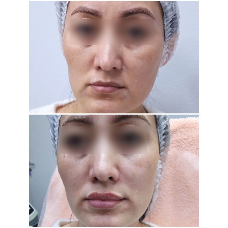 2907624__https://filllin.ru/api/media/doctor/6b13236c-1eda-44e6-b0a3-cd9fa87fcfc2-6641d6971b708b73903b2c1d.jpg