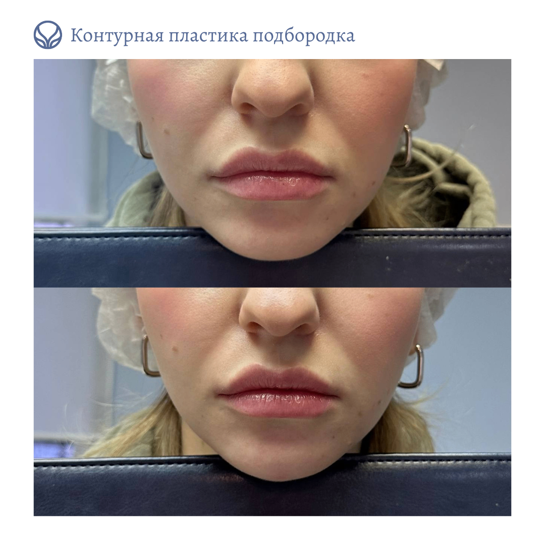 63553855__https://filllin.ru/api/media/doctor/6ea8c70a-3bf9-4234-aeef-7dfe05711e34-6641d6971b708b73903b2c1d.png