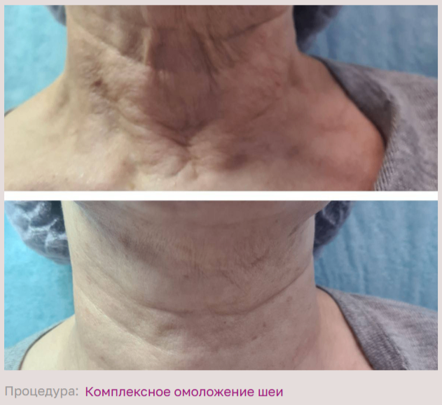 602492197__https://filllin.ru/api/media/doctor/72516856-b0be-4377-b228-79208bdf956a-68d2b334d611ae3c0dcef079.png