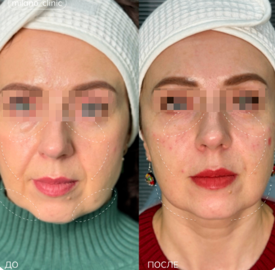 529020855__https://filllin.ru/api/media/doctor/72fda4c4-3b87-4965-bc0a-829d16dc242d-68d2b334d611ae3c0dcef079.png