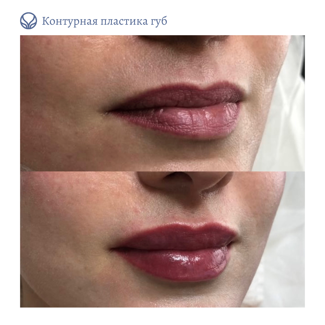 63553855__https://filllin.ru/api/media/doctor/7404d164-8001-4f95-8214-c62f69de2dba-6641d6971b708b73903b2c1d.png