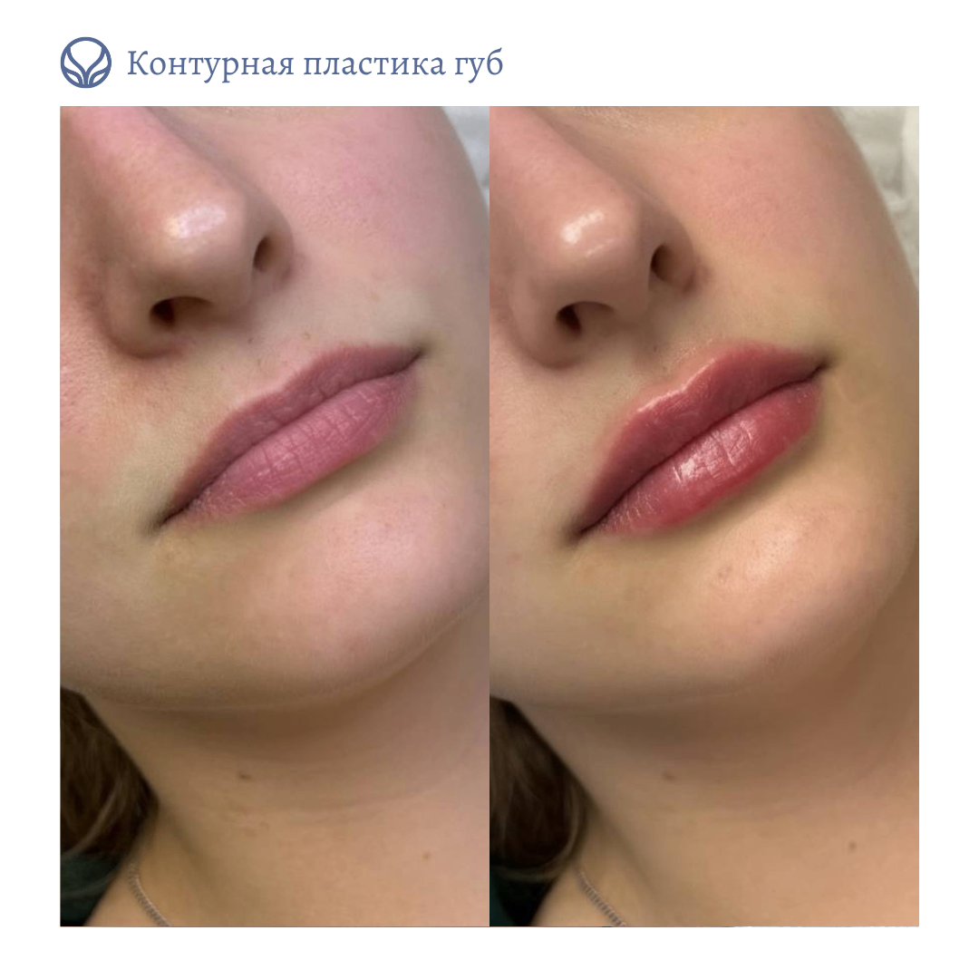 63553855__https://filllin.ru/api/media/doctor/753907fe-c5bb-4e95-b155-4b5c0f11d239-6641d6971b708b73903b2c1d.png