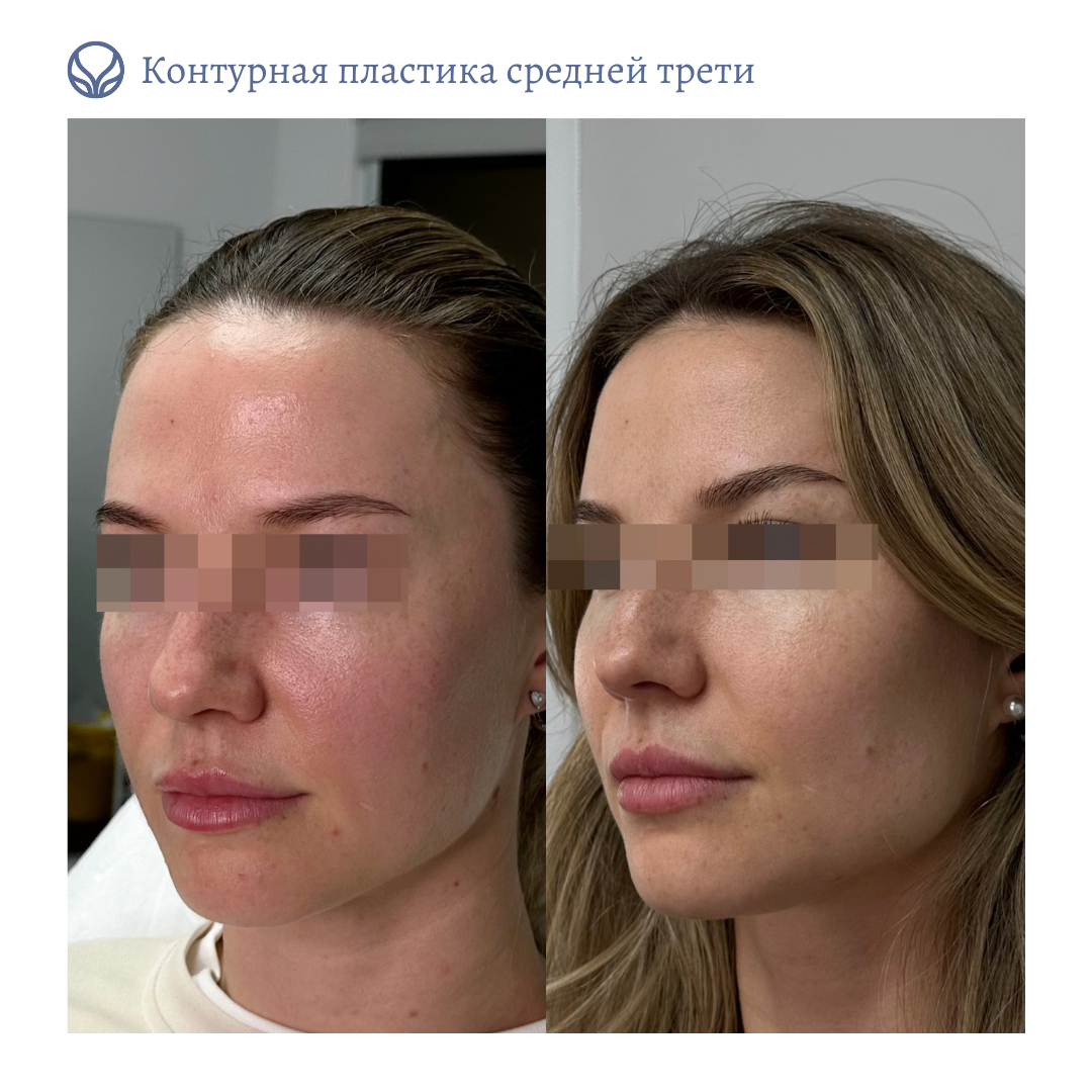 64844681__https://filllin.ru/api/media/doctor/758c4e99-af72-4864-8854-8720c10320f2-6641d6971b708b73903b2c1d.png