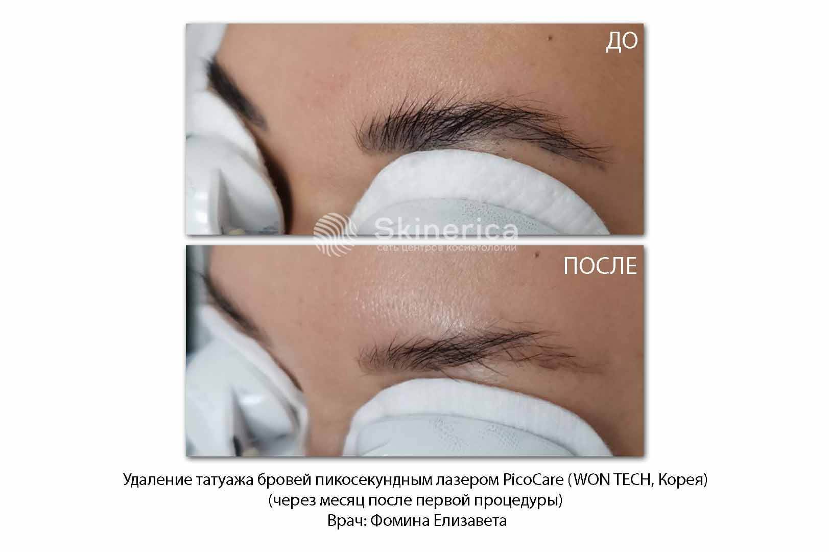 211570337__https://filllin.ru/api/media/doctor/79ce8bd0-d024-415f-9369-54d33d2fa11e-6641d6971b708b73903b2c1d.jpg