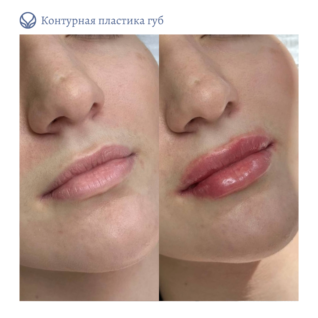63553855__https://filllin.ru/api/media/doctor/7bf262bf-7faa-448c-867f-7137f78868f9-6641d6971b708b73903b2c1d.png
