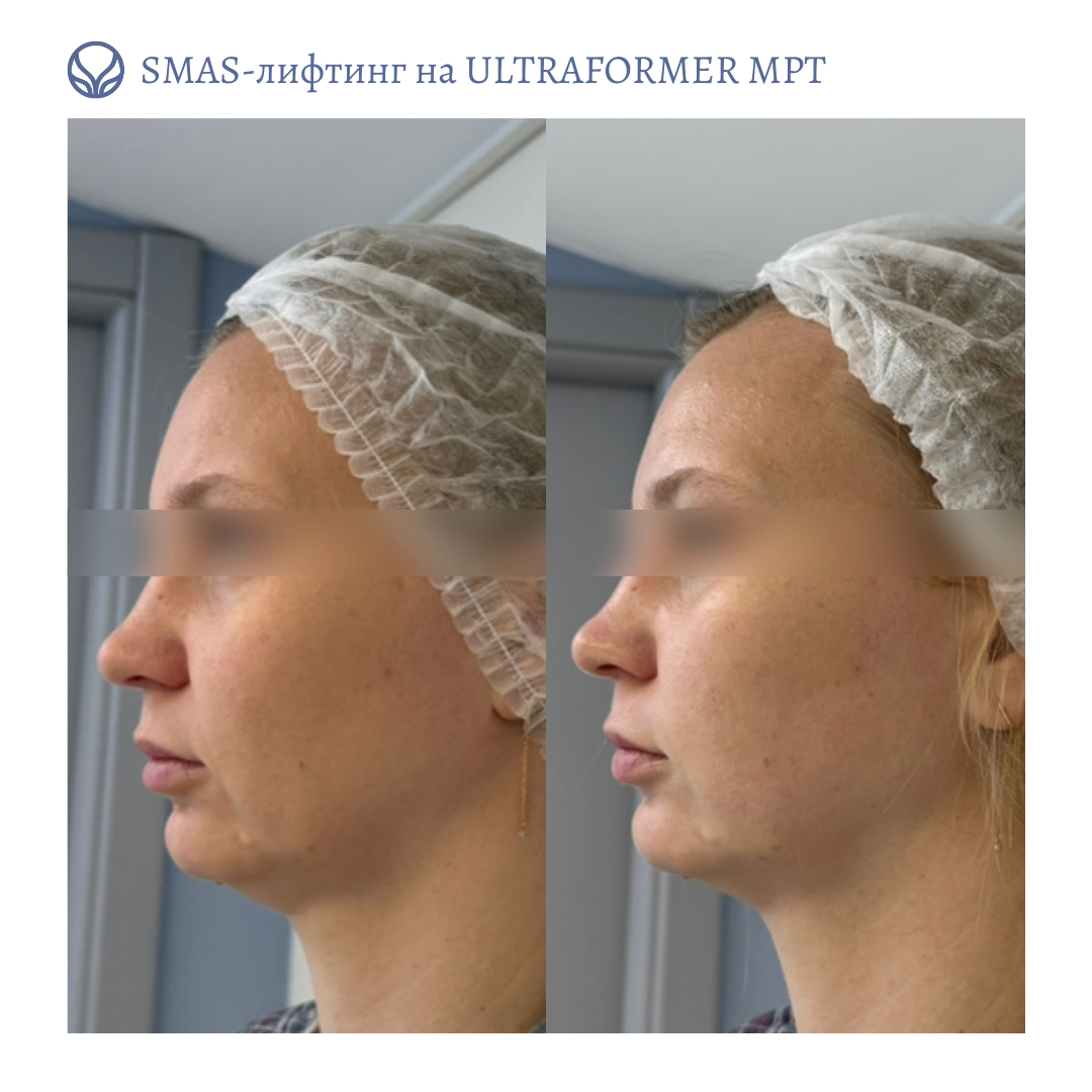 63553855__https://filllin.ru/api/media/doctor/7fc4eed1-225f-4c10-a78e-50e1f15d1651-6641d6971b708b73903b2c1d.png