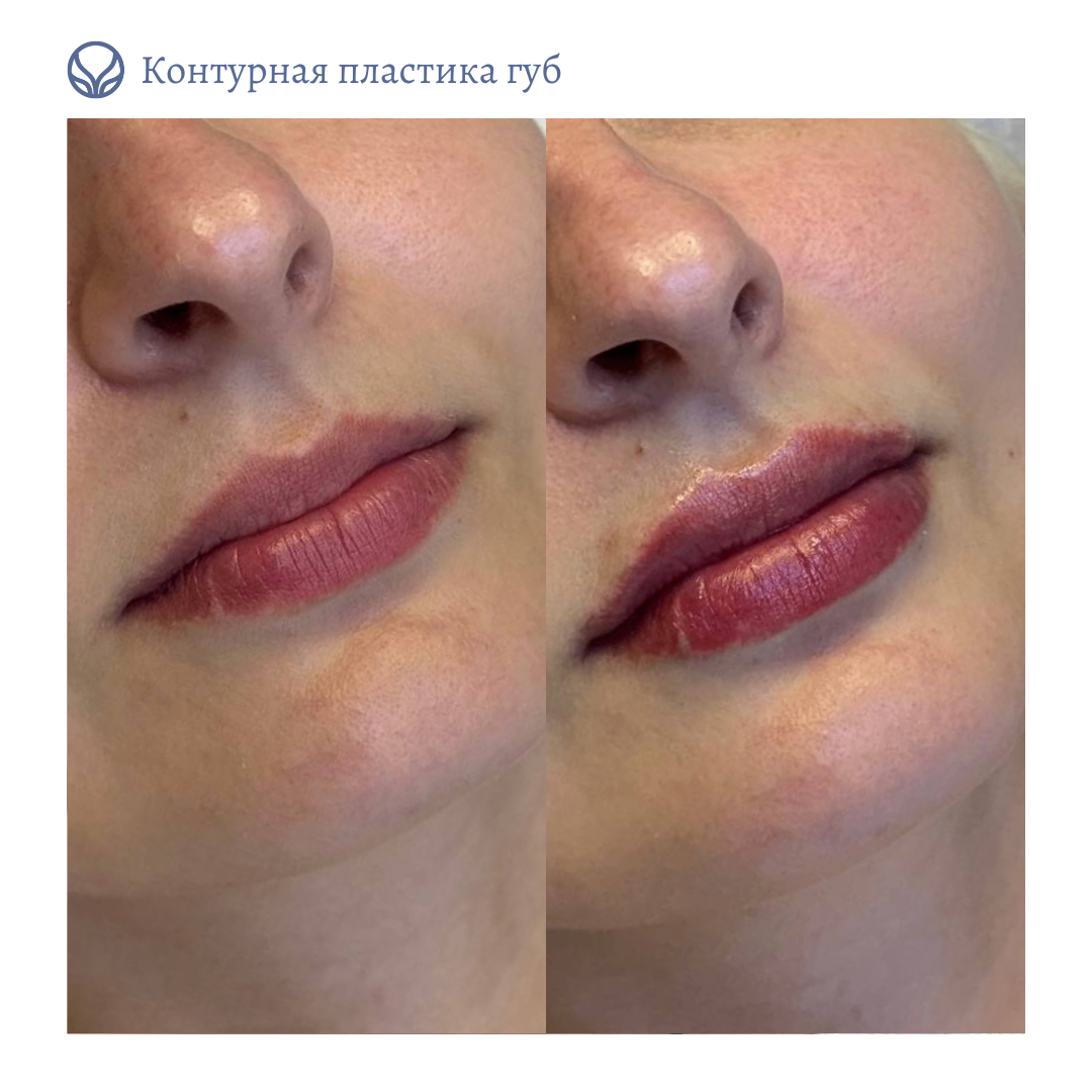 63553855__https://filllin.ru/api/media/doctor/7fcc7ac9-6136-4e9e-b37e-d5fe52f32249-6641d6971b708b73903b2c1d.png