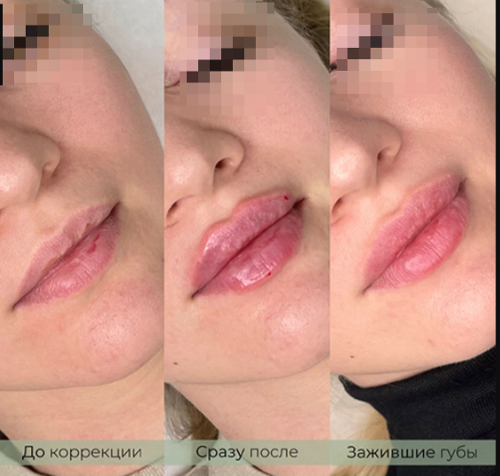 135377169__https://filllin.ru/api/media/doctor/8172dd32-8232-4356-ba24-d3ba26301c52-6641d6971b708b73903b2c1d.png