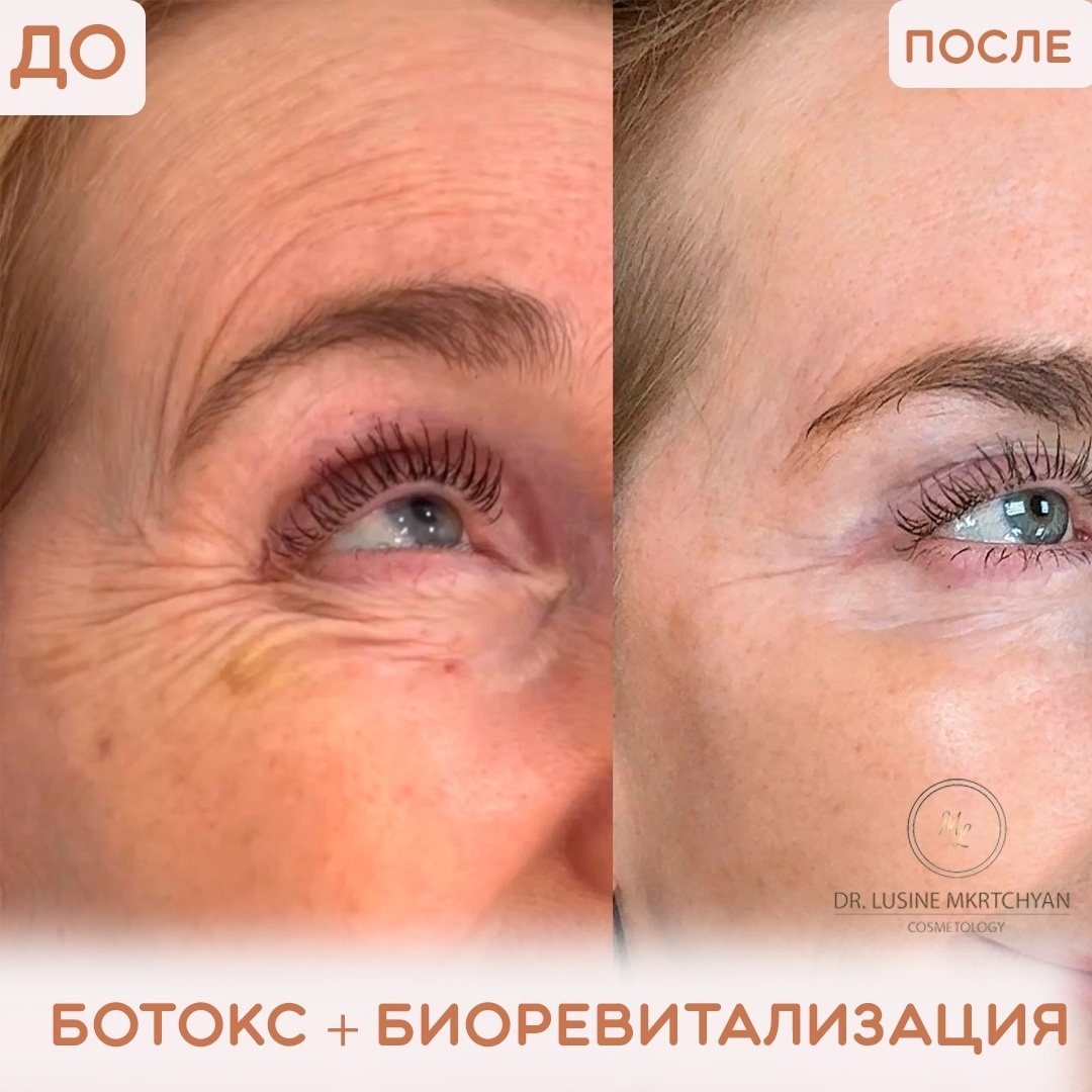 528607536__https://filllin.ru/api/media/doctor/820ddac4-ede1-4d6b-b756-4c90e445a141-68d2b334d611ae3c0dcef079.jpg