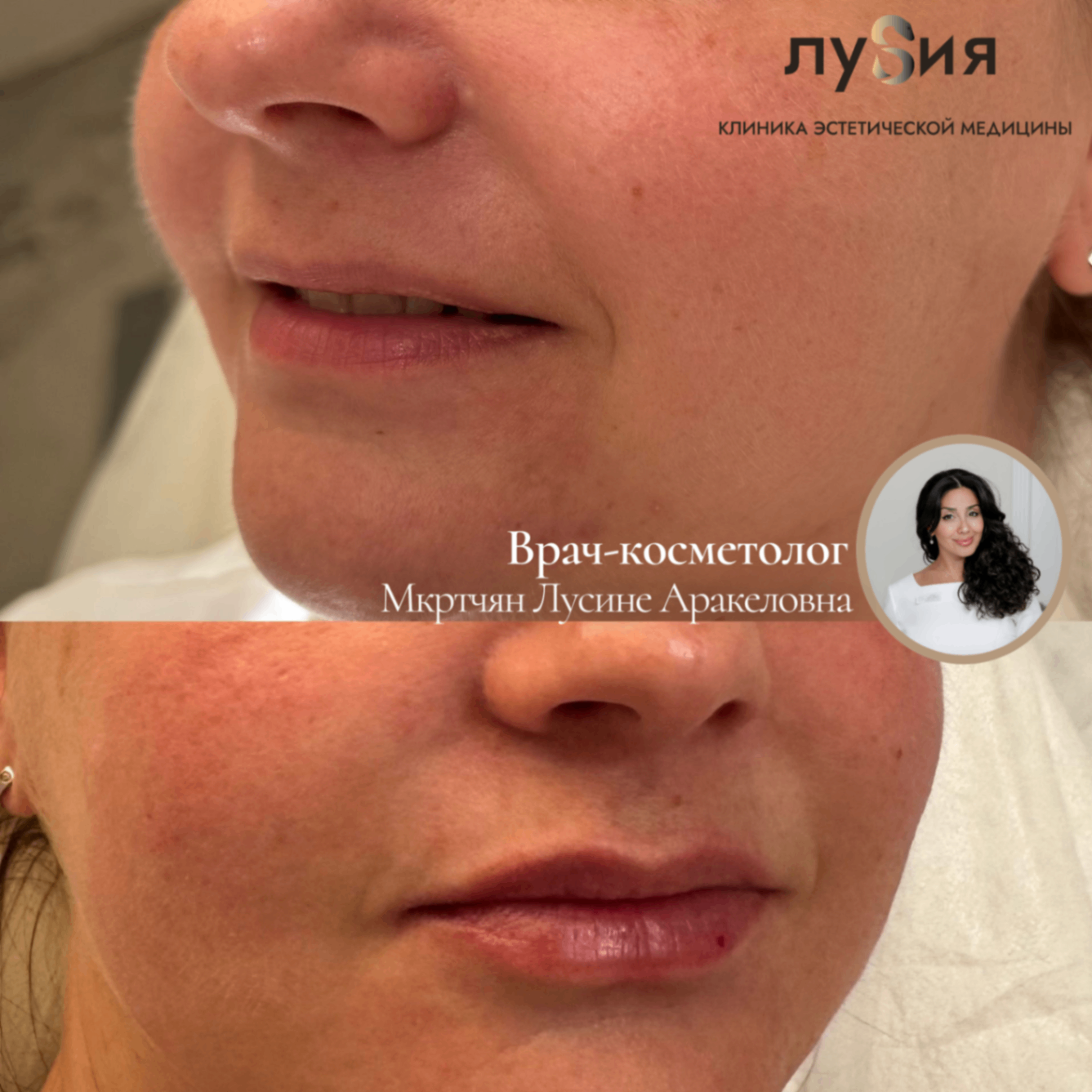529741701__https://filllin.ru/api/media/doctor/826976ff-99e5-4695-8b6e-020b67e354f9-68d2b334d611ae3c0dcef079.png