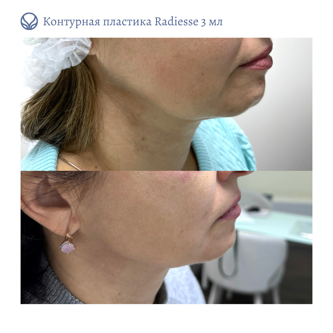 66825615__https://filllin.ru/api/media/doctor/82c5e75d-aa38-480a-a630-f6bcfbcbc034-6641d6971b708b73903b2c1d.png