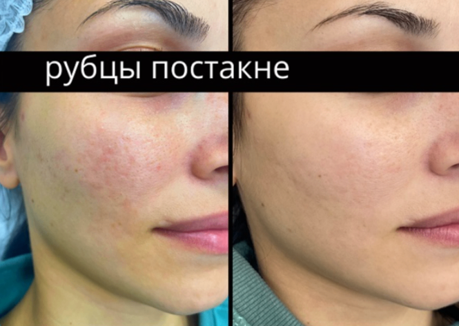 158321839__https://filllin.ru/api/media/doctor/8391a79a-9df8-4808-8bab-ccbf4eda72a6-6641d6971b708b73903b2c1d.png