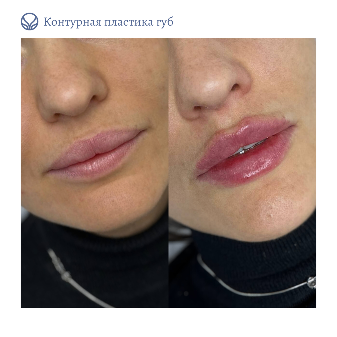 66825615__https://filllin.ru/api/media/doctor/8394ba06-c15a-4e74-b5dd-73bd2f2483f9-6641d6971b708b73903b2c1d.png