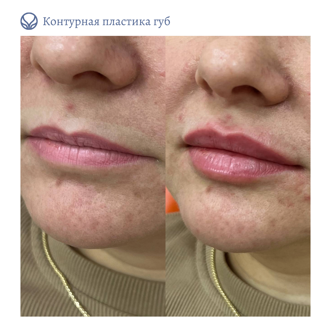 64764445__https://filllin.ru/api/media/doctor/84d71d9d-f936-47dc-8ad9-ccc926fcef1f-6641d6971b708b73903b2c1d.png