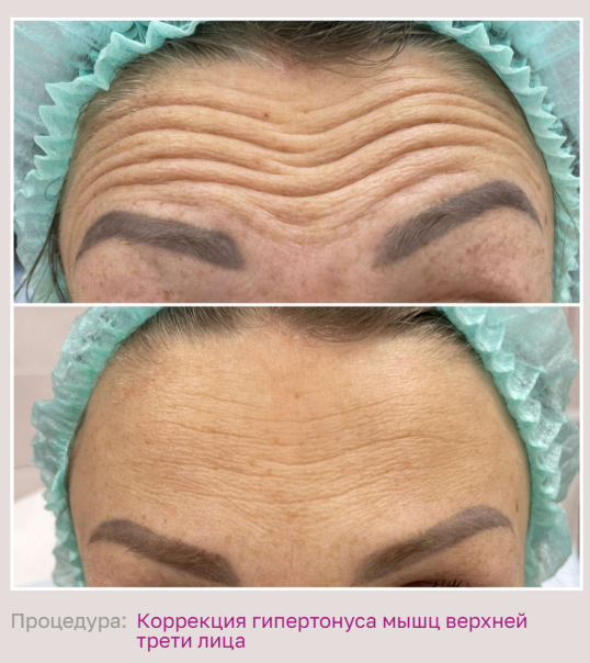 602492197__https://filllin.ru/api/media/doctor/87b5de90-09b7-487e-8360-de002dd23ab8-68d2b334d611ae3c0dcef079.png
