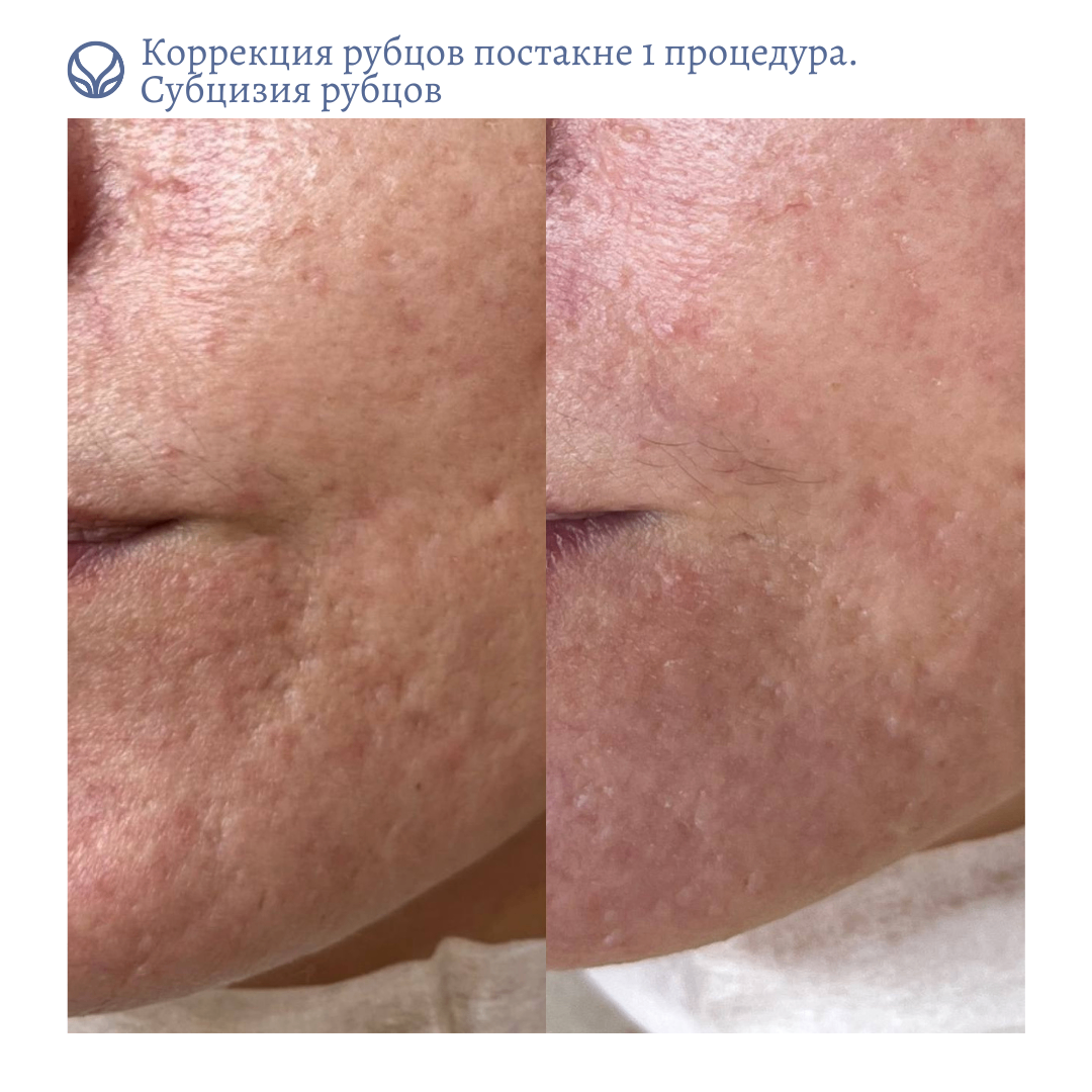 66773718__https://filllin.ru/api/media/doctor/87eb79d3-1a0e-498f-ac6b-0244a1d0a3d3-6641d6971b708b73903b2c1d.png