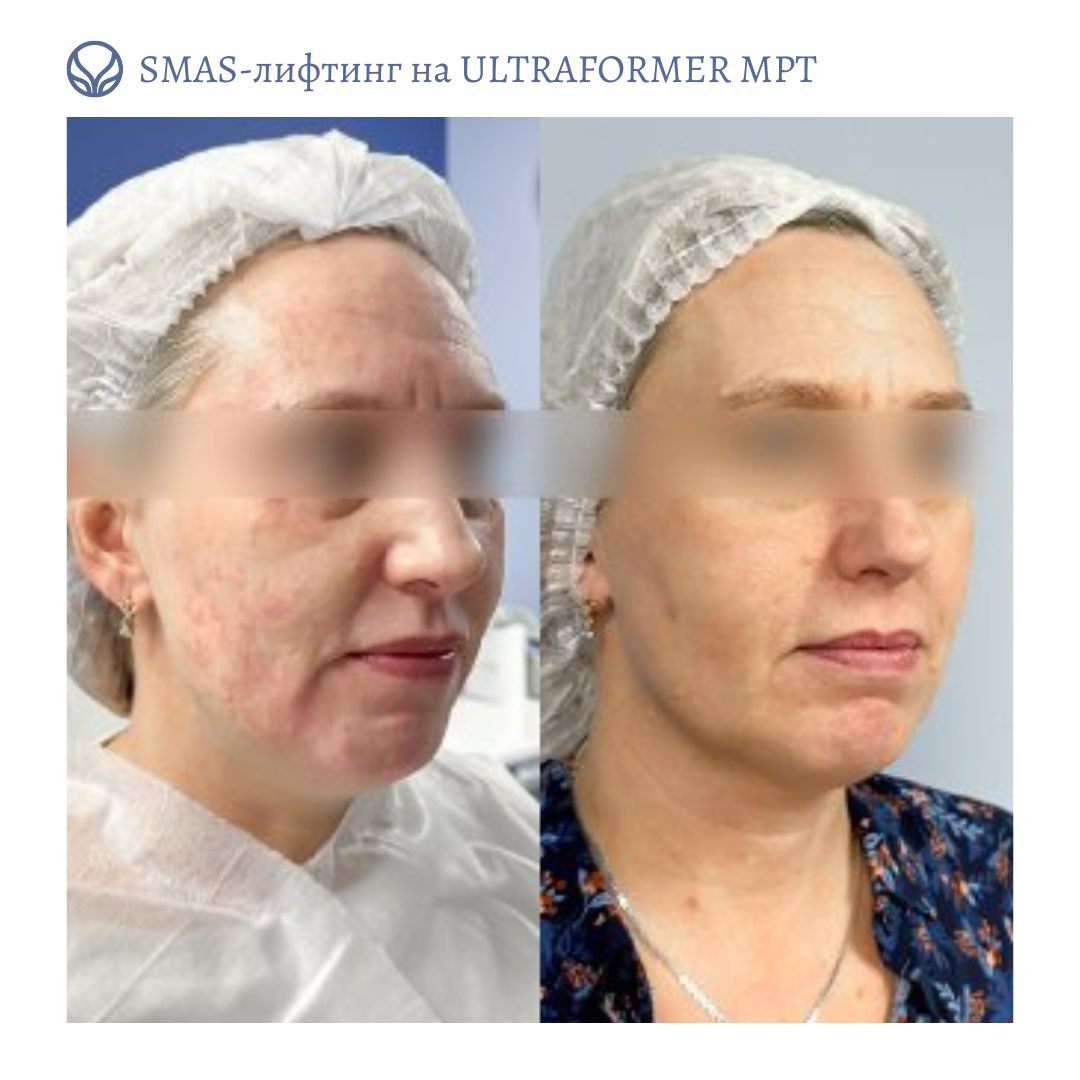 63553855__https://filllin.ru/api/media/doctor/88f58247-13f5-4403-9b94-b76c681533d8-6641d6971b708b73903b2c1d.jpg