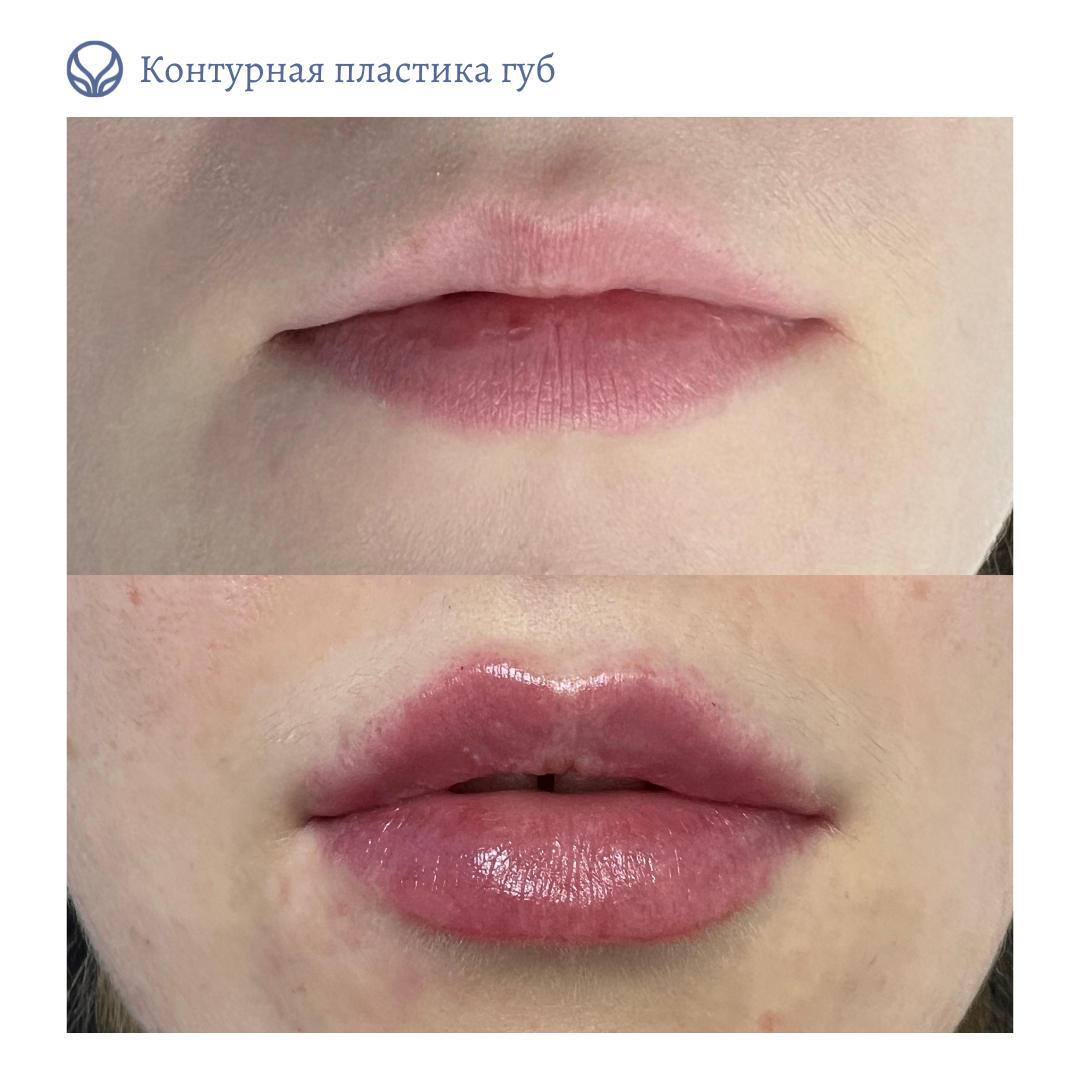 64764445__https://filllin.ru/api/media/doctor/8a1bc5c9-f257-40dd-843c-efeefd521bc1-6641d6971b708b73903b2c1d.png