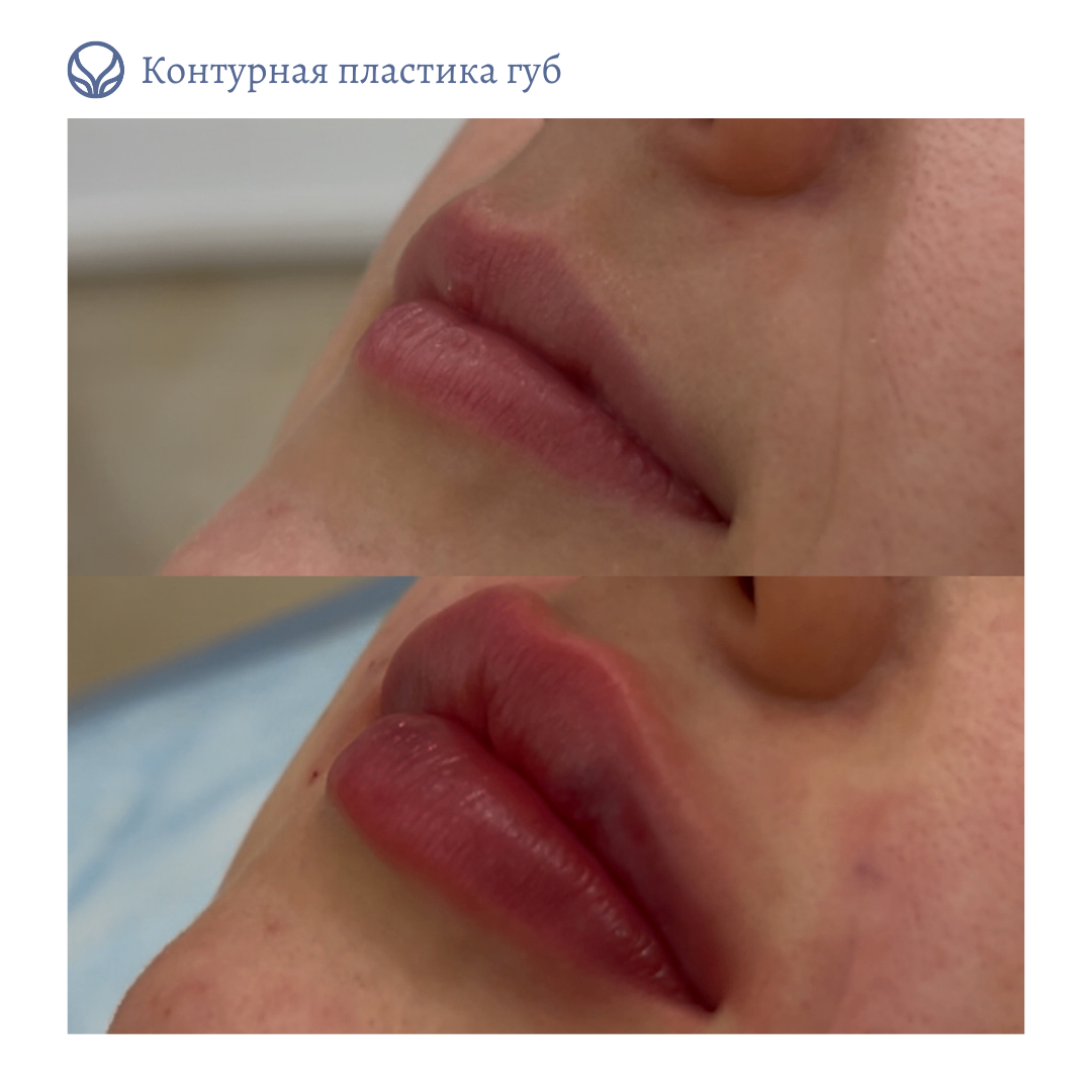 63550010__https://filllin.ru/api/media/doctor/8a314563-2ef2-4069-89f0-c204e6fcdfa1-6641d6971b708b73903b2c1d.png