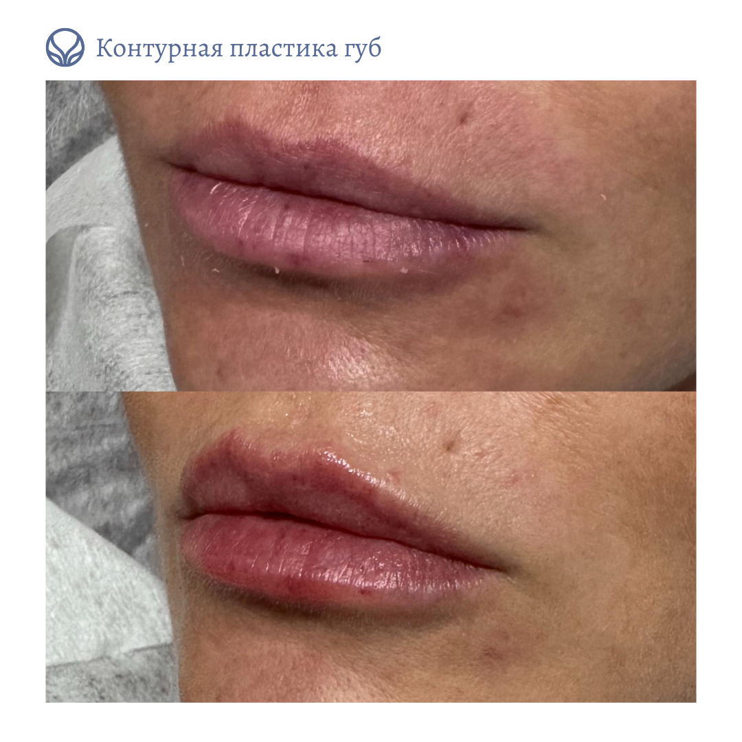 63553855__https://filllin.ru/api/media/doctor/8a6ab364-fd9d-4a1e-b6de-90573f5489cd-6641d6971b708b73903b2c1d.png